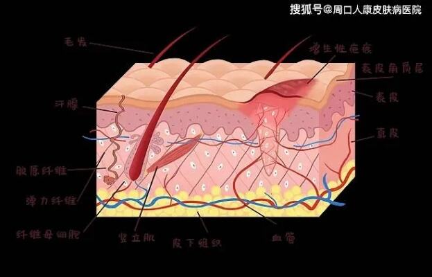 周口人康皮肤病医院